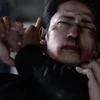 瀉血