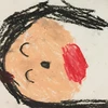たらこ唇