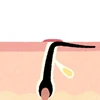 毛