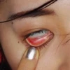 咬筋肥大