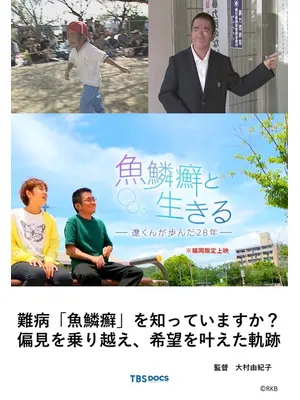 魚鱗癬と生きる ー遼くんが歩んだ２８年ー