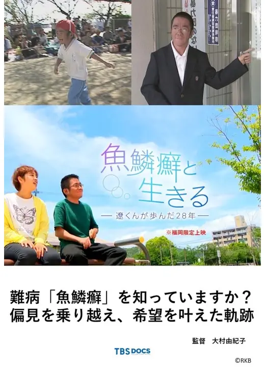 魚鱗癬と生きる ー遼くんが歩んだ２８年ー