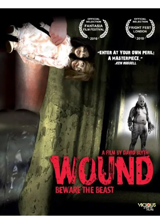 Wound