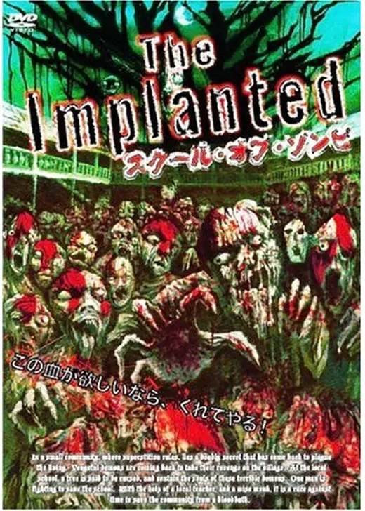 The Implanted スクール･オブ･ゾンビ