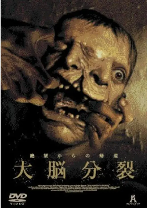 大脳分裂